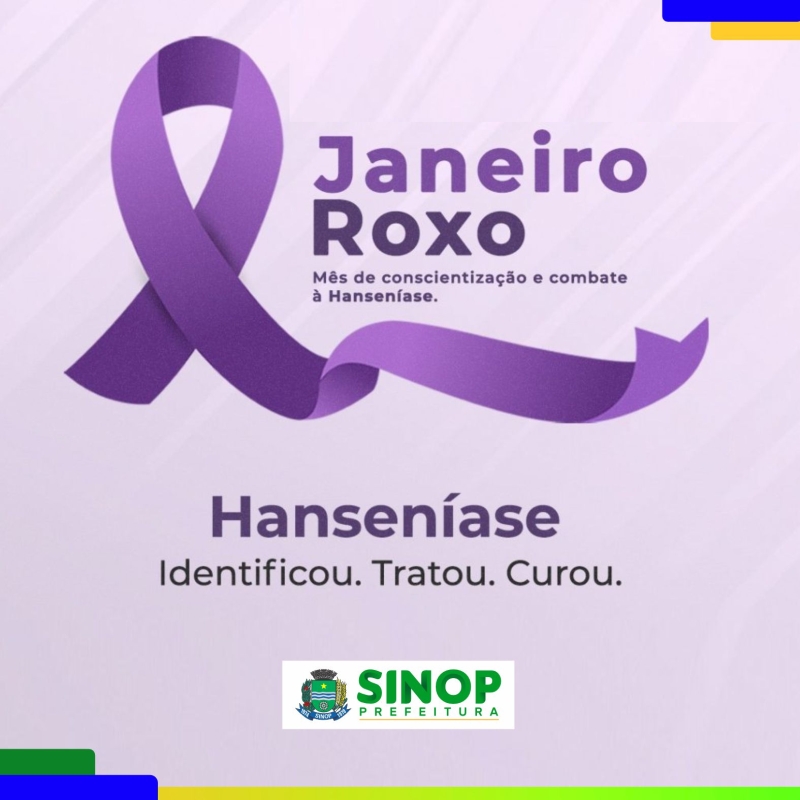 Janeiro Roxo: Prefeitura de Sinop intensifica as ações de combate à Hanseníase