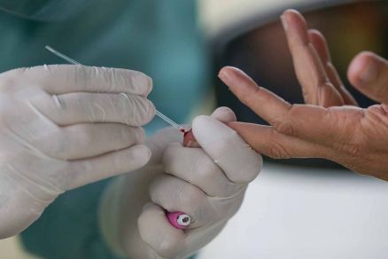 Mato Grosso registra 2,3 mil casos e 91 mortes por Covid-19 em 24 horas