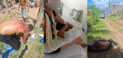 Castigo em Cuiabá:  Vingança facção dá salve em criminoso que decepou dedos da ex